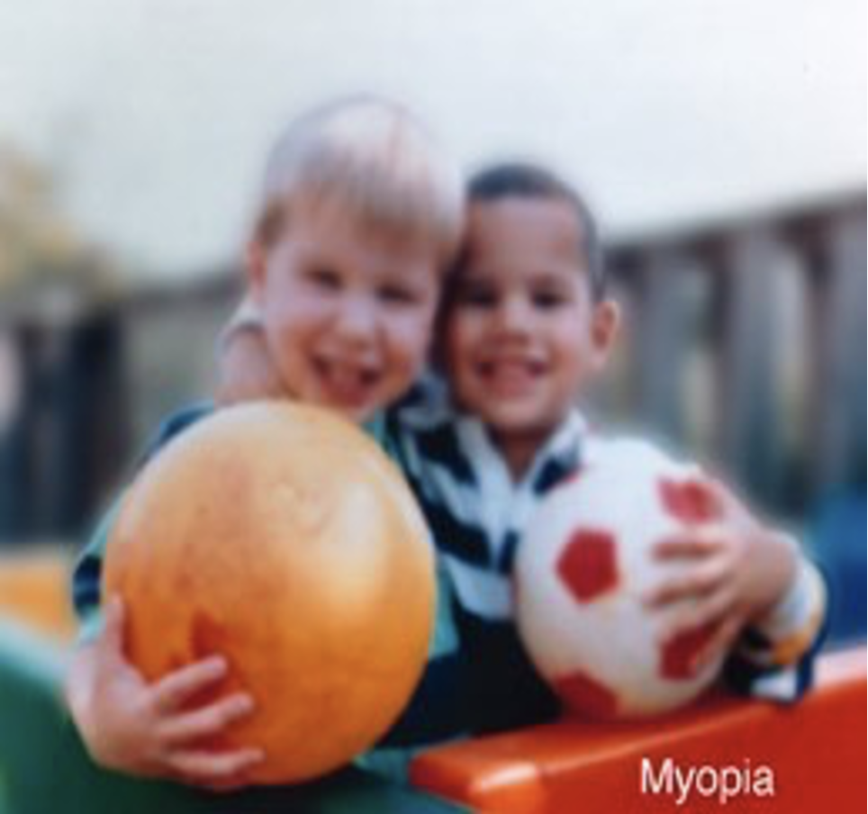 myopia vision